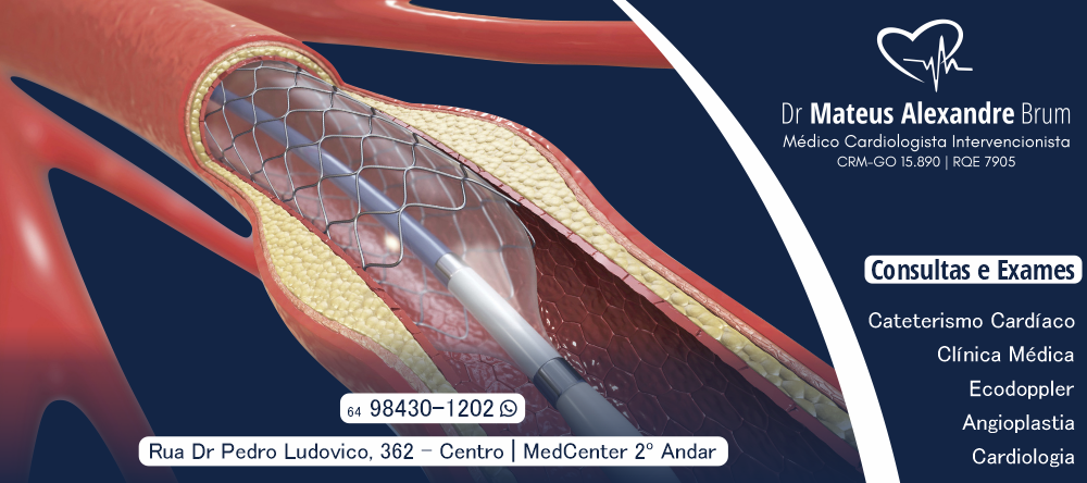 banner DR MATEUS ALEXANDRE BRUM CARDIOLOGISTA 